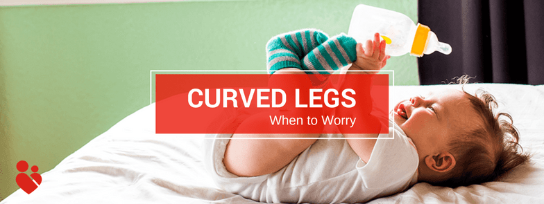 Curved Legs | When to Worry