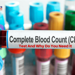 What is CBC Test & Why Do You Need It?