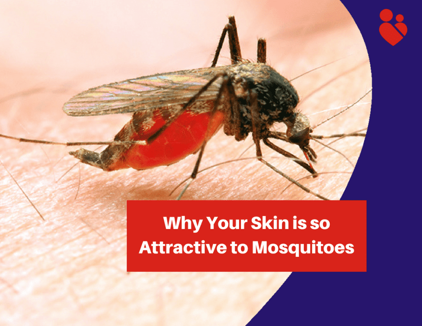 Why Your Skin Is So Attractive To Mosquitoes
