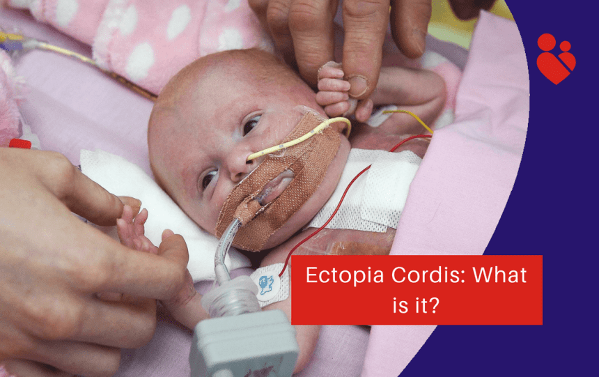 Ectopia Cordis: What is it?