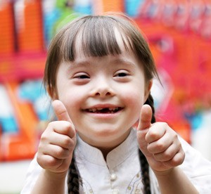down-syndrome/birth-defects