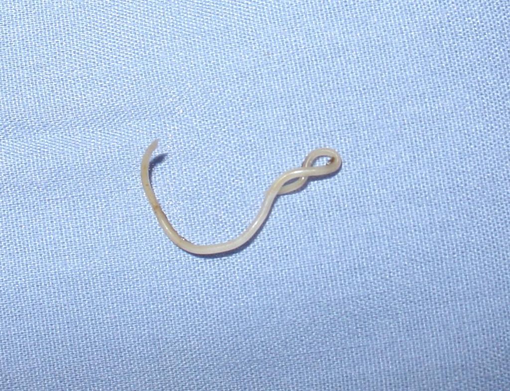 roundworms in stool
